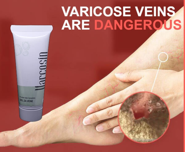 Varcosin Gel krem per venat varikoze